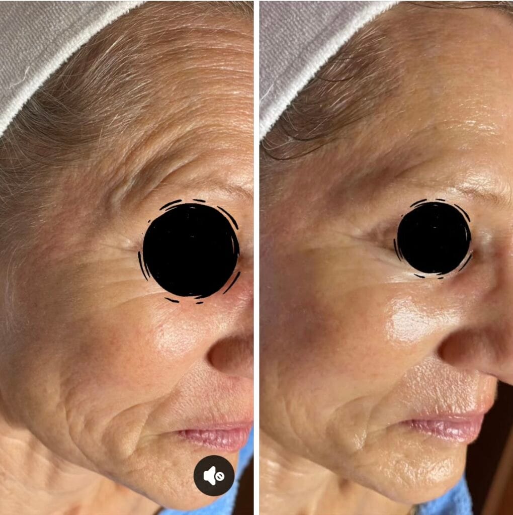 Pflanzliche Kollagen